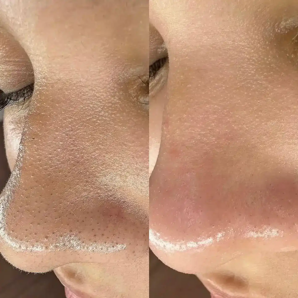 Dr. Melaxim Peel Shot K-Derma Solution